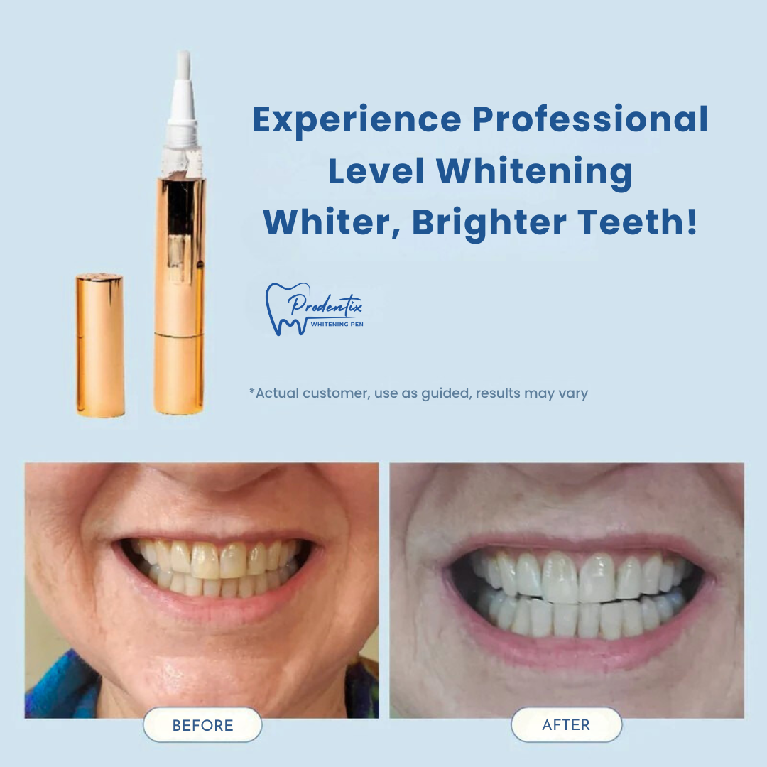 Prodentix Teeth Whitening Pen